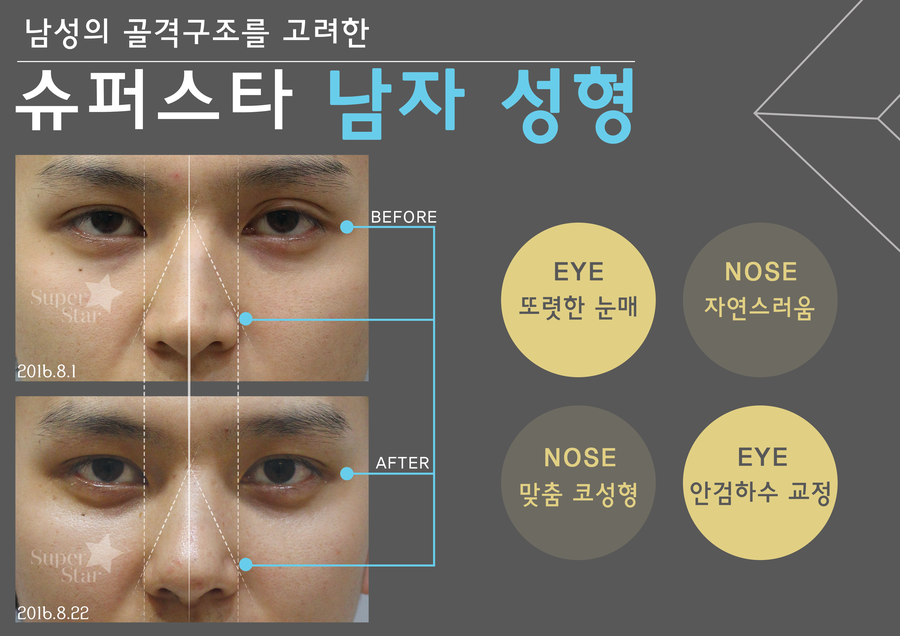 [구로대림에 남자성형잘하는병원 찾으세요?] 슈퍼스타메디컬그룹이 있습니다~~! 관련 이미지 1