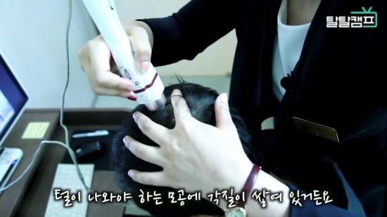 [구로탈모] 구로 슈퍼스타피부과의 탈모 프로젝트 탈탈캠프 ! 관련 이미지 4
