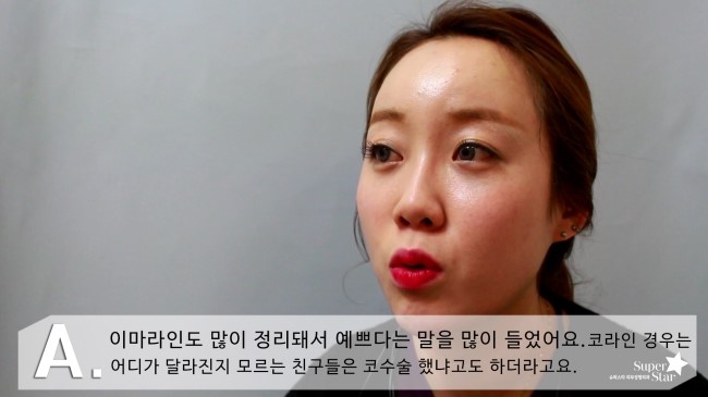 [구로성형]눈밑지방제거+얼굴지방이식=슈퍼리턴즈지방이식! 쏘다미의 수술후 한달! 관련 이미지 4