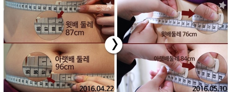 [구로피부과전문의]-비만패키지 세번째 이야기 관련 이미지 2