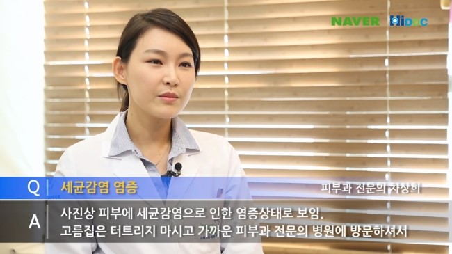 여드름 관리하는 방법 & 여드름 짜는 방법 관련 이미지 6