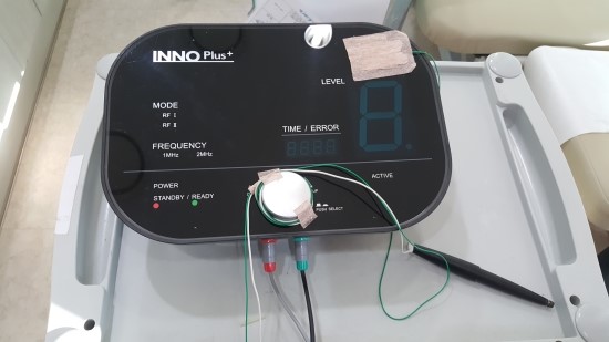 입술에 생긴 노란반점~ 포다이스반을 아시나요? 관련 이미지 4