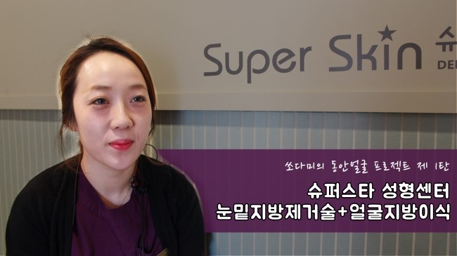 [구로눈성형]슈퍼스타 쏘다미의 동안얼굴 프로젝트~!!제 1편 준비했답니다!! 수술 전 소다미의 심정! 리얼하게 보여드려요~ 관련 이미지 1