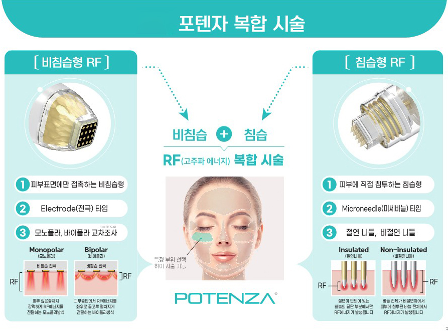 구로디지털단지역피부과 포텐자로 모공 흉터 탄력 리프팅까지! 관련 이미지 3