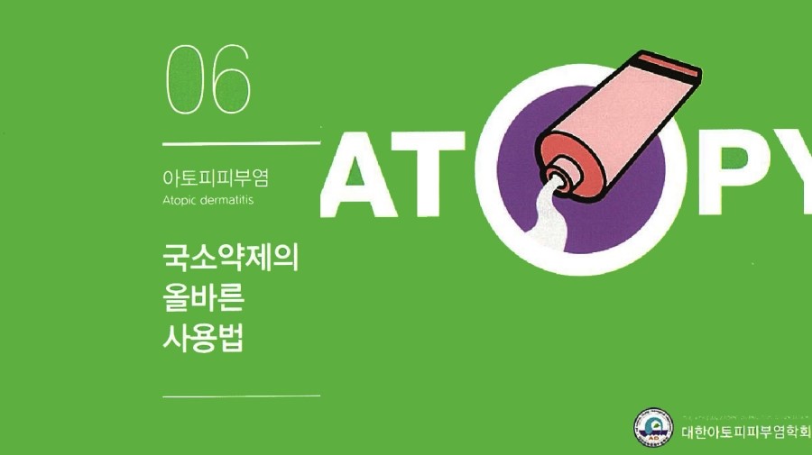 [구로피부과전문의]슈퍼스타피부과에서 알려주는 피부질환 이야기. 아토피 피부염-6 관련 이미지 2