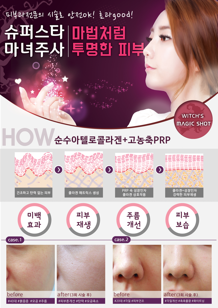 [구로피부과전문의]마녀주사! 마법처럼 투명한 피부를 만드는 마법의 주사 마녀주사, 슈퍼스타피부과에서 만나보세요~ 관련 이미지 1