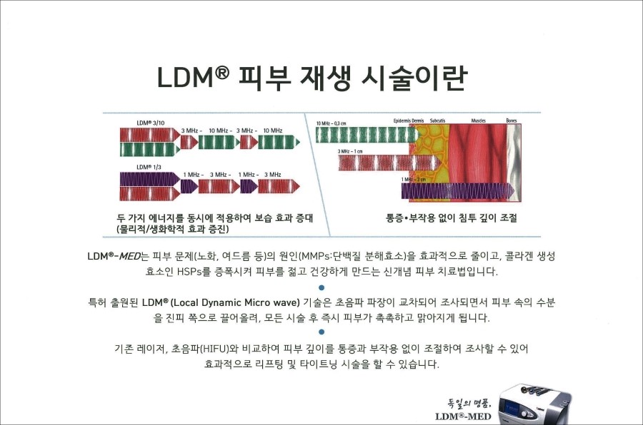 [구로피부과전문의]슈퍼스타피부과에서 알려주는 미용시술 이야기 - 물방울리프팅 [ LDM 리프팅 ] 관련 이미지 6