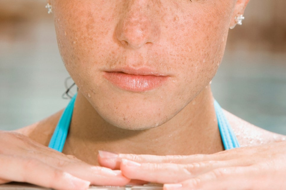 구로디지털피부과 추천? 기미주근깨 레이저, &lsquo;이것&rsquo;만 확인하시면 됩니다. 관련 이미지 1