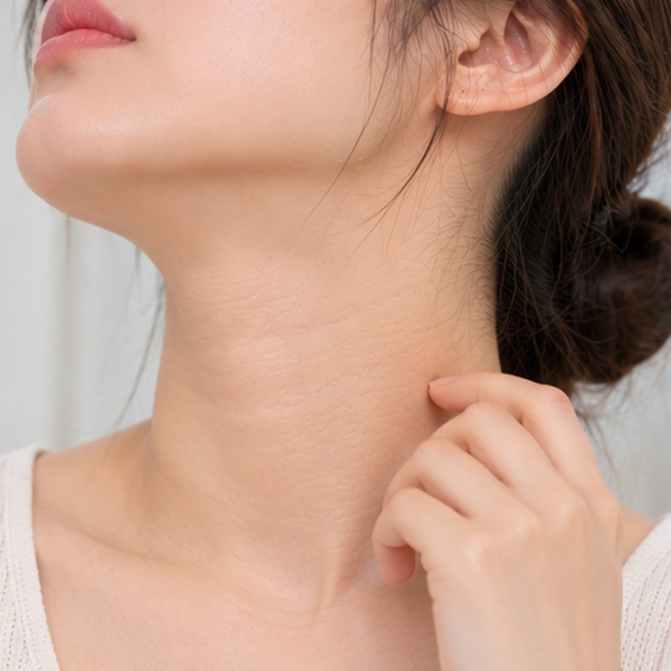 당산역피부과 아토피 치료, 피부가 괜찮아진 뒤에도 가려움이 먼저 다시 시작된다면? 관련 이미지 4