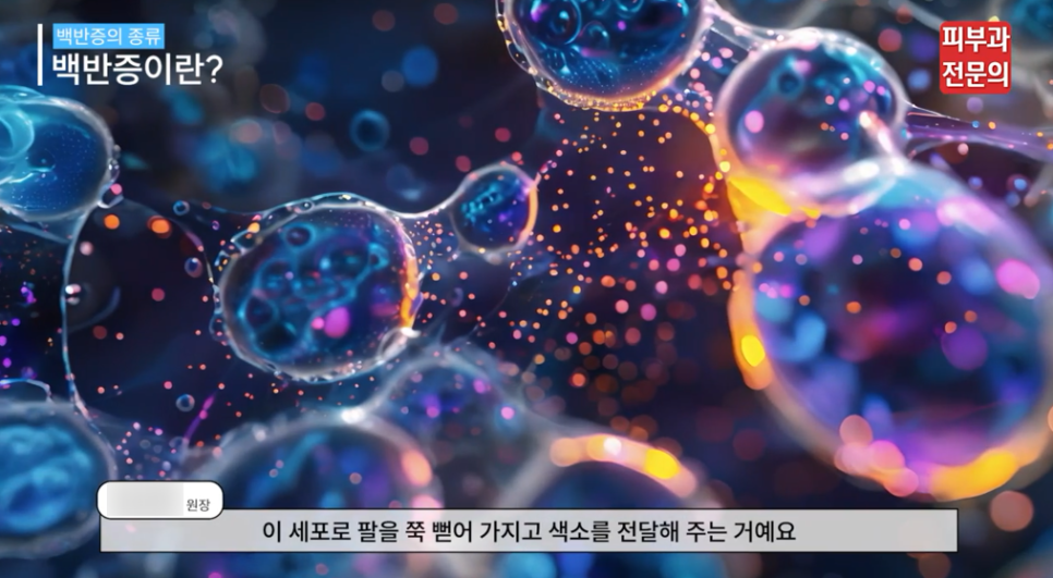 백반증치료방법 엑시머 레이저 장점과 기대 효과는? <총정리> 관련 이미지 2