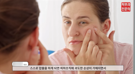염증성여드름치료 피부과, 관리에 힘써야 하는 이유? 관련 이미지 5