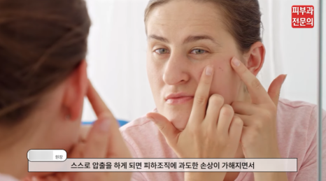 서울 여드름흉터제거 피부과, 색소침착 함몰흉터 치료 방법은? 관련 이미지 3