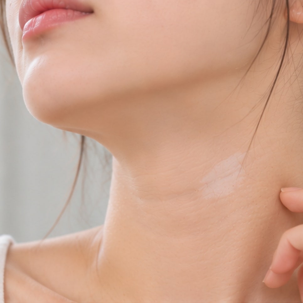샛강역피부과 백반증 증상, 흰 반점의 경계가 점점 넓어지는 것 같다면 무엇을 확인해야 할까요? 관련 이미지 2