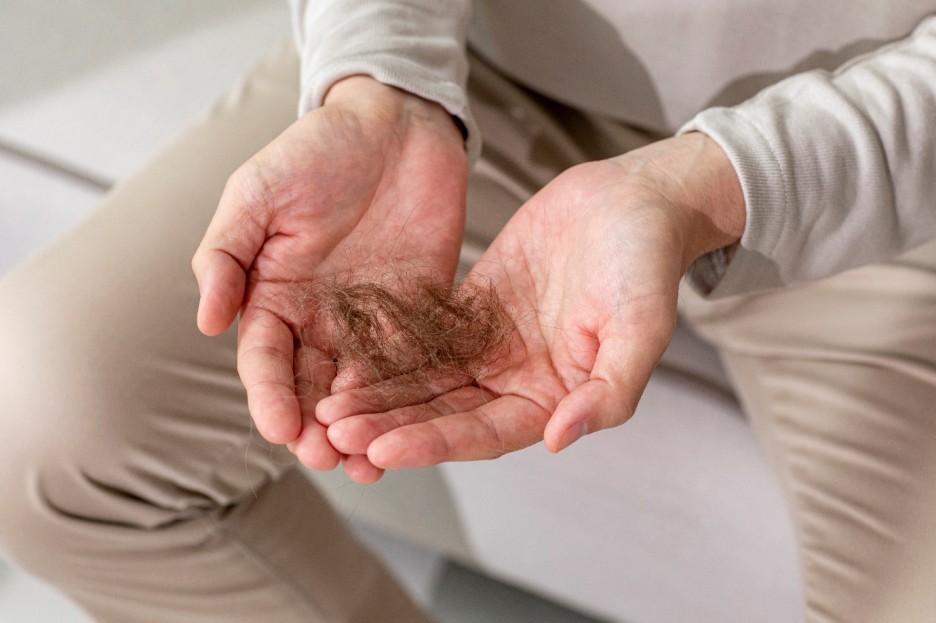 영등포시장역피부과? 탈모 먹는약 바르는약 치료 전 꼭 아셔야 할 것 관련 이미지 3