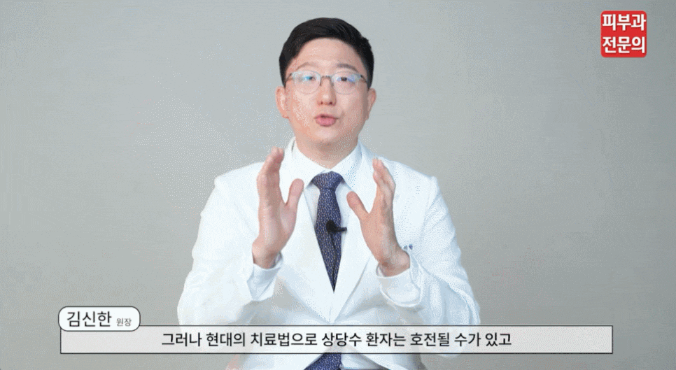 백반증 초기에 알아두면 좋은 증상 특징과 관리 포인트 관련 이미지 4