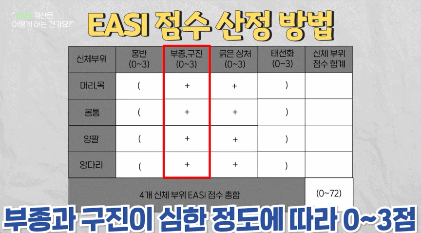 심한 중증아토피 치료 피부과? EASI 점수를 계산해야 하는 이유 관련 이미지 3