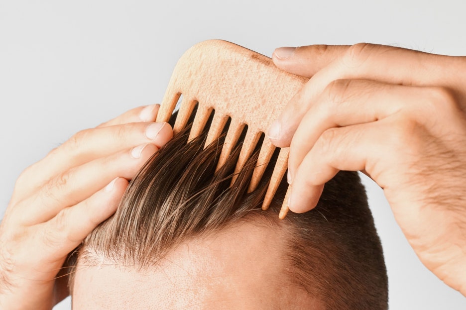 여의도탈모병원 추천, 민간요법에 대해 피부과 전문의가 답해드립니다. 관련 이미지 6