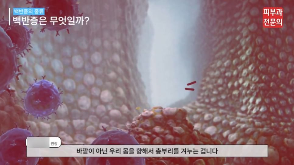 백반증바르는약 치료, 피부과에서 가장 중요하게 생각하는 1가지 관련 이미지 4