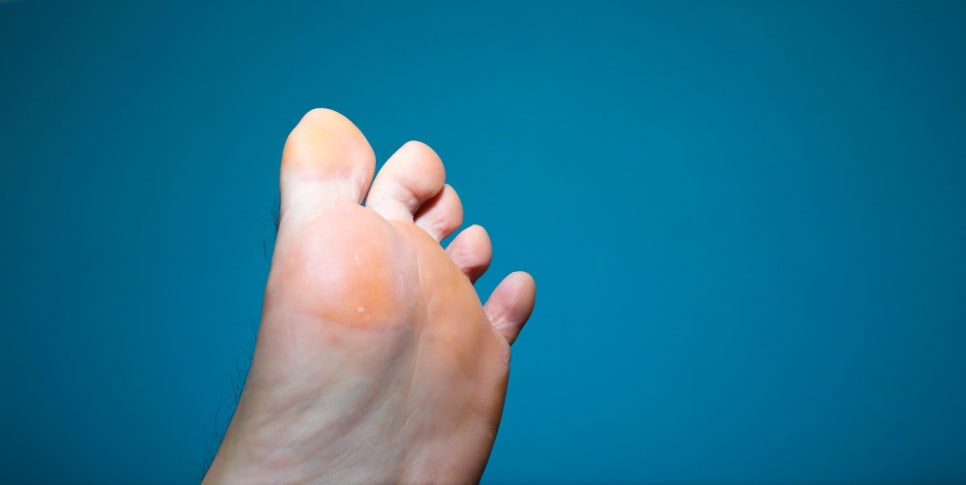 대방역피부과 추천? 발바닥무좀병원을 찾고 계시다면 필독하세요. 관련 이미지 3