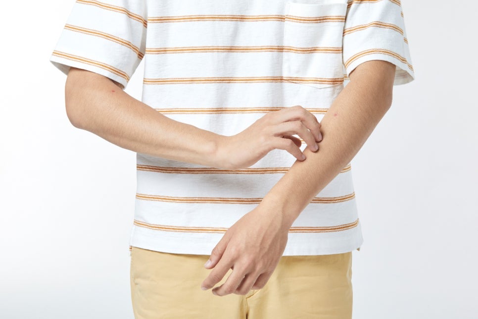 영등포건선 치료, 피부각질원인 관련 이미지 1