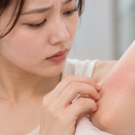 당산역피부과 아토피 치료, 피부가 괜찮아진 뒤에도 가려움이 먼저 다시 시작된다면? 관련 이미지 2