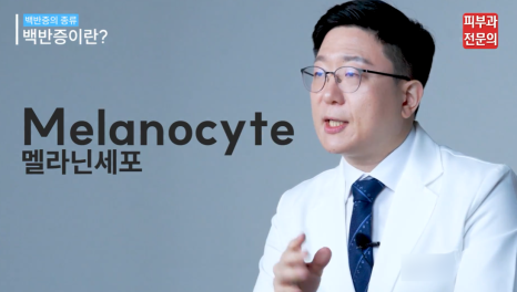 피부백반증치료 방법, 이것만 꼭 살펴보세요. 관련 이미지 2
