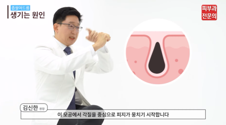 서울 여드름치료병원 안전한 치료를 위해 꼭 기억하셔야 할 것 관련 이미지 4