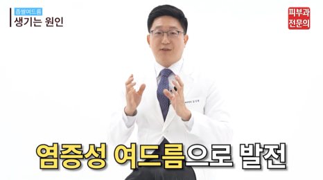 블랙헤드 화이트헤드 치료 피부과, 건강한 피부를 위한 핵심 정보 관련 이미지 3