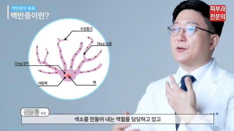 영등포구청역피부과 백반증 레이저 치료, 이것만 알고 가세요! 관련 이미지 2