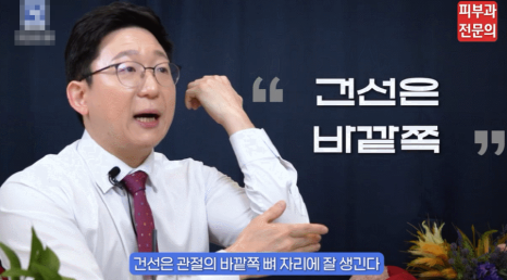 피부 건선연고 치료 어떤 성분을 통해 진행되나요? <피부과 전문의 작성> 관련 이미지 6