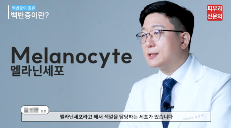 백반증약 처방 병원, 면역억제연고 치료에 대한 정보 관련 이미지 2