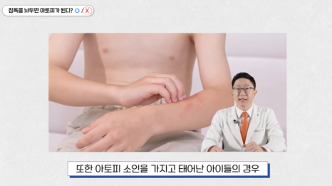 서울 소아아토피병원, 스테로이드 연고 치료 시 주의해야 할 것 관련 이미지 3