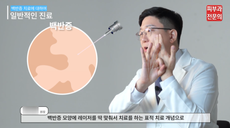 백반증엑시머 레이저 치료 전 꼭 알고 계셔야 할 핵심 정보 관련 이미지 7