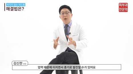 서울 10대여드름 피부과, 연고 치료 시 꼭 기억해야 할 1가지 관련 이미지 3