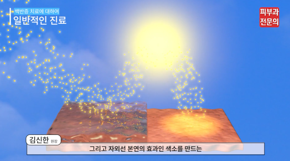 백반증치료피부과 전문의 진단 치료 시 가장 중요한 것은? 관련 이미지 6