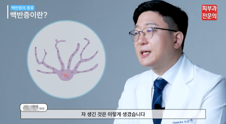 백반증치료방법 문래역피부과 전문의가 알려드립니다. 관련 이미지 4