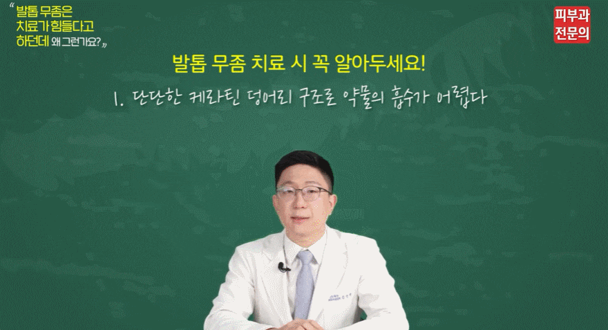 서울 발톱무좀치료피부과? 대표적인 오해 3가지에 대해 짚어드립니다. 관련 이미지 3