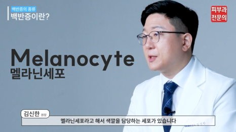 피부변색 치료, 백반증 엑시머 레이저의 핵심은? 관련 이미지 3