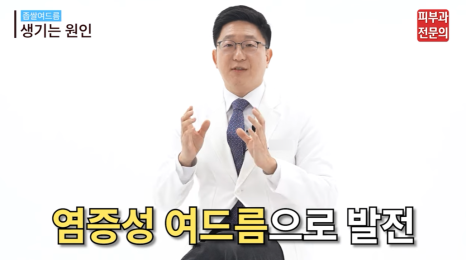 여드름스케일링 피부과, 환자별로 다르게 진행되어야 하는 이유 관련 이미지 2