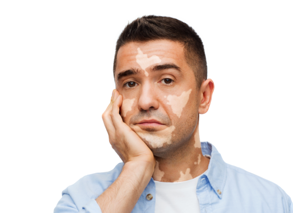 서울 백반증레이저피부과를 찾고 계시다면&hellip; 관련 이미지 3