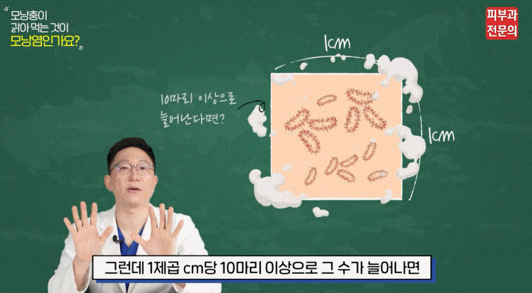 양평역피부과 추천? 모낭충에 대한 오해와 진실 관련 이미지 4