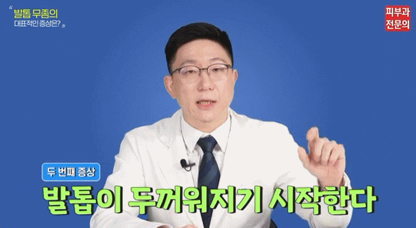 발톱무좀에 대하여 A부터 Z까지 짚어드립니다. 관련 이미지 1