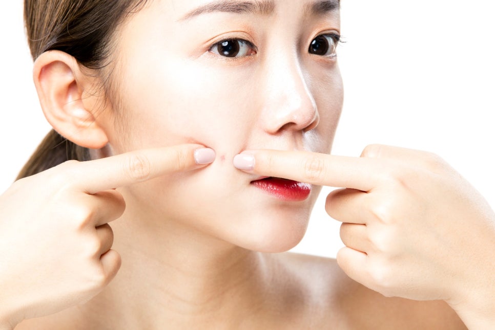 영등포여드름 치료 병원, A to Z 로 정리해 드립니다. 관련 이미지 1