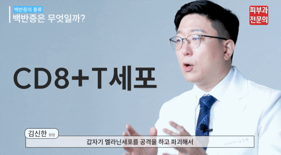 자가면역피부질환 피부하얀점 원인, 백반증 관련 이미지 5
