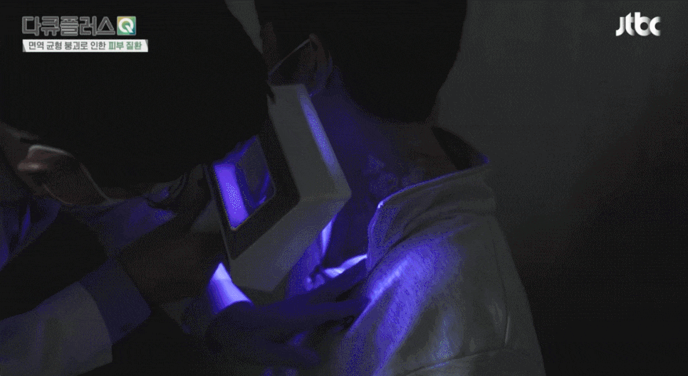 영등포피부과 전문의가 생각하는 피부 질환 치료의 핵심 (JTBC 다큐플러스Q 굿닥터) 관련 이미지 10