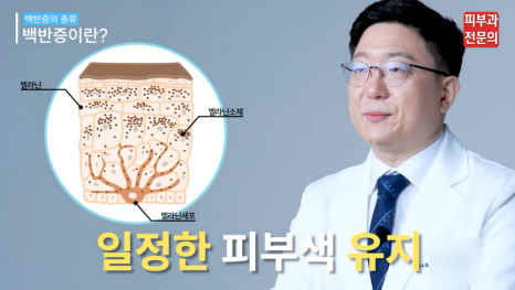 백반증치료방법 엑시머 레이저 장점과 기대 효과는? <총정리> 관련 이미지 4