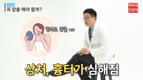화농성 여드름 압출방법, 스스로 짜내기 전에 꼭 읽어 보세요. (피부과 전문의 작성) 관련 이미지 7