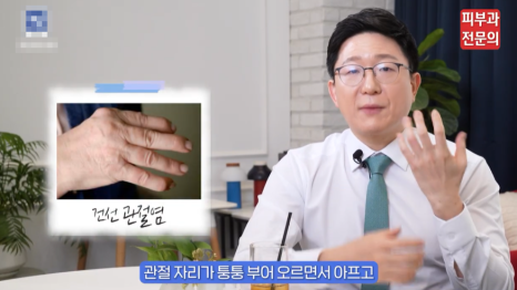 영등포구피부과 추천, 건선? 이대로 방치하면 안 되는 이유 관련 이미지 7