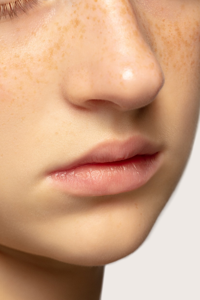 목동피부과 추천? 기미레이저토닝, 전문의는 이렇게 합니다. 관련 이미지 3