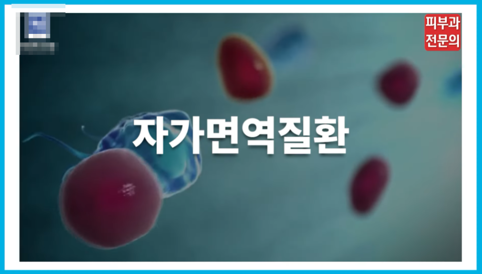 건선엑시머 치료에 있어서 가장 중요한 핵심 정보 관련 이미지 2